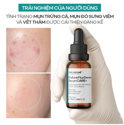 Serum Cho Da Dầu Mụn Cafuné
