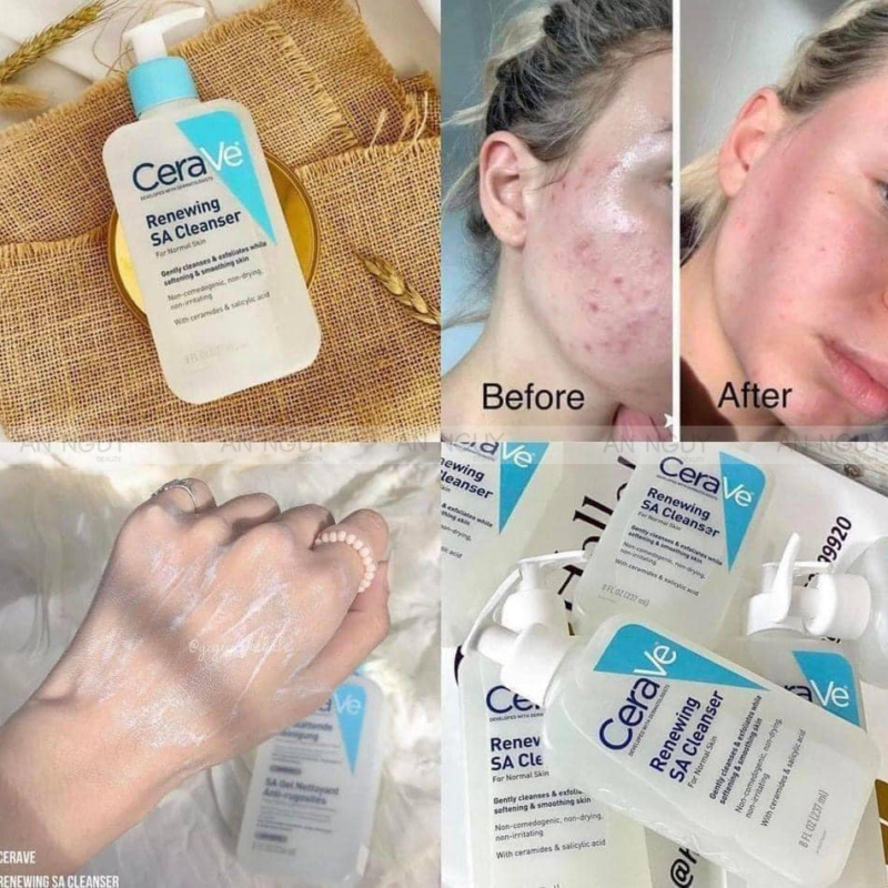 Công dụng của sữa rửa mặt CeraVe cho da dầu