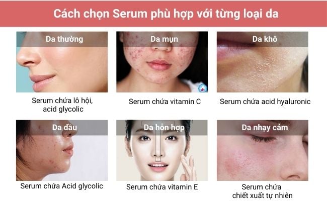Dùng serum mỗi ngày có tốt cho da không